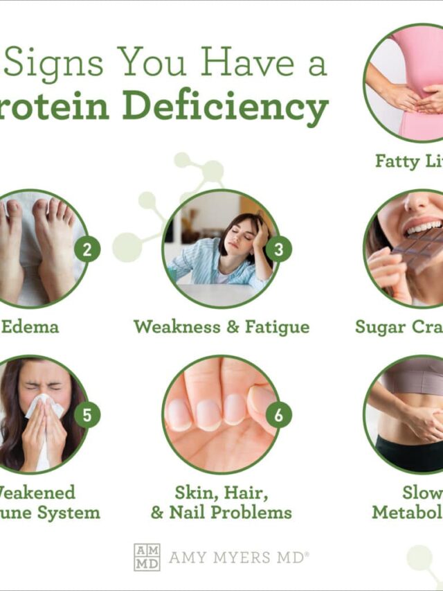 8 signs to detect protein deficiency